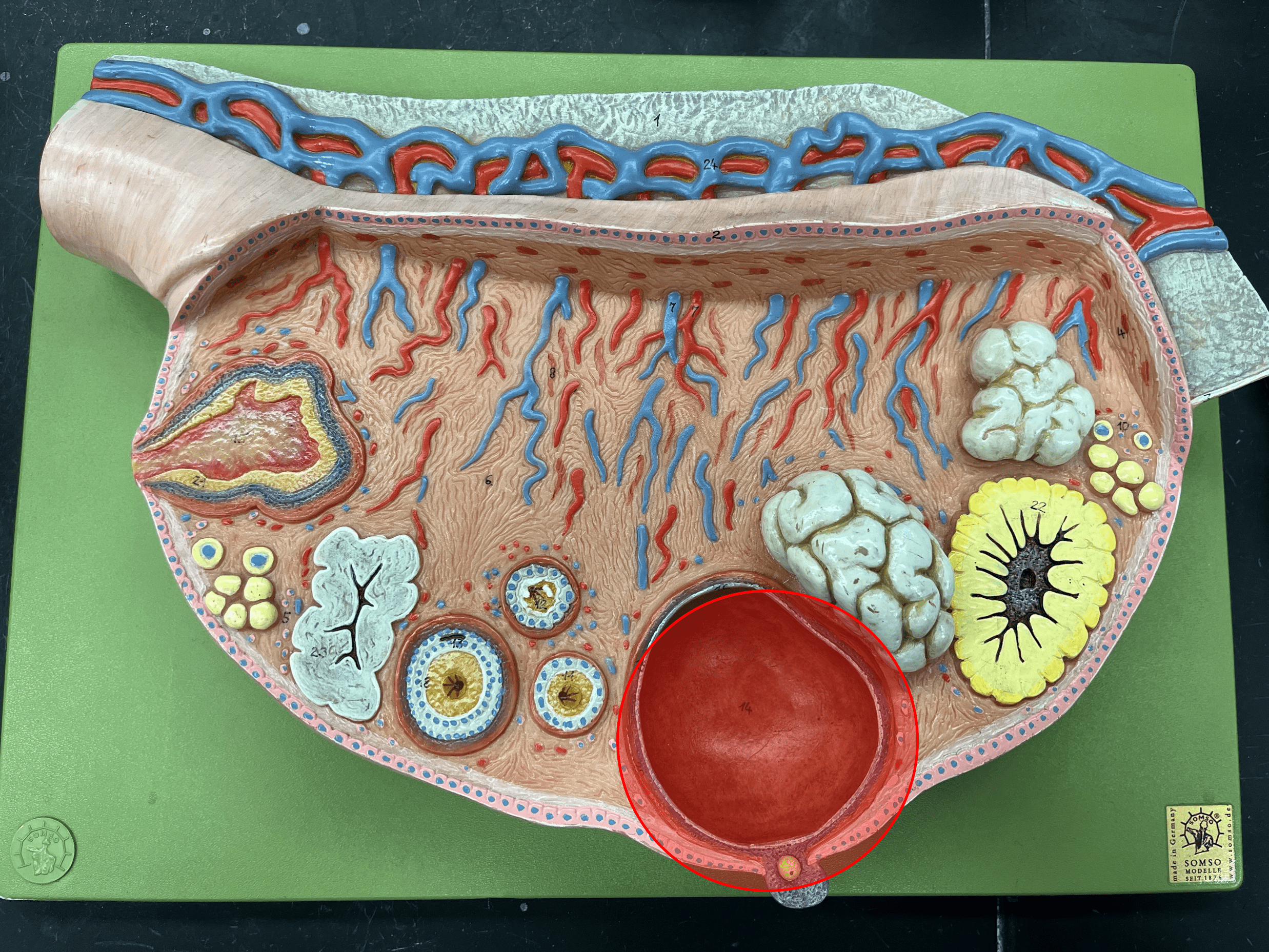 • A ring of supportive cells surrounding an oocyte.

• Composed of a larger antrum and a corona radiata surrounding the oocyte.

• Also known as a tertiary or mature follicle.