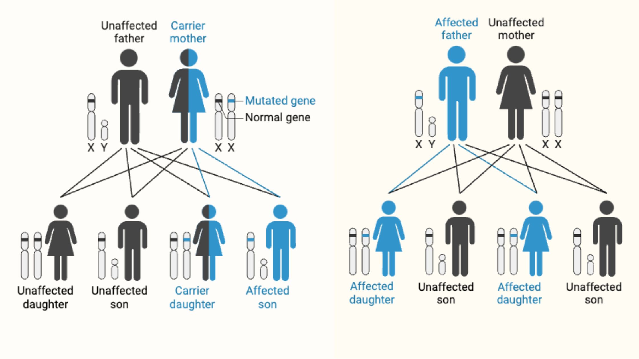 <p><span>Sex-linked inheritance means a gene is on the sex chromosomes (usually the X). Boys (XY) only have one X, so if they get a faulty gene there, they show the trait. Girls (XX) have two Xs, so they usually need two faulty genes to show it. That’s why some traits, like color blindness, happen more in boys.&nbsp;</span></p>