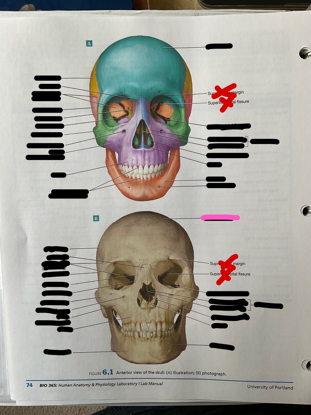 What bone is this?