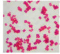 <p>What is the name of this kind of bacteria?</p>