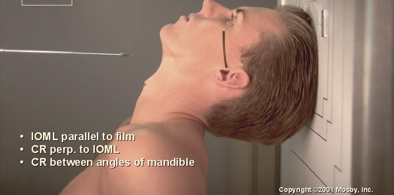 <p>What position is this?</p>