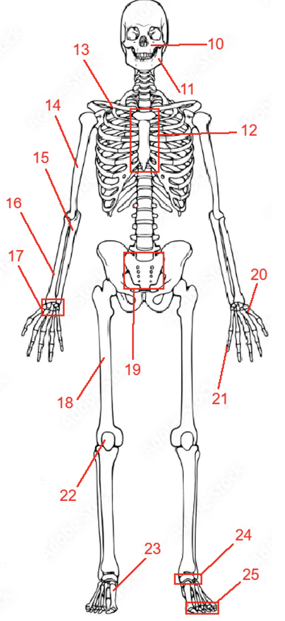 <p>Label items <strong>21-25.</strong></p>