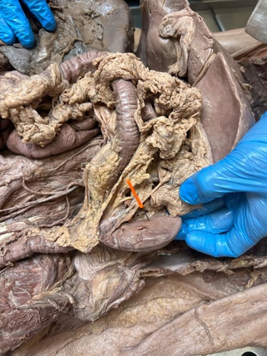 <p>spleen</p>