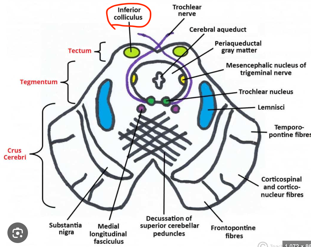 <p>Inferior colliculus nucleus</p>