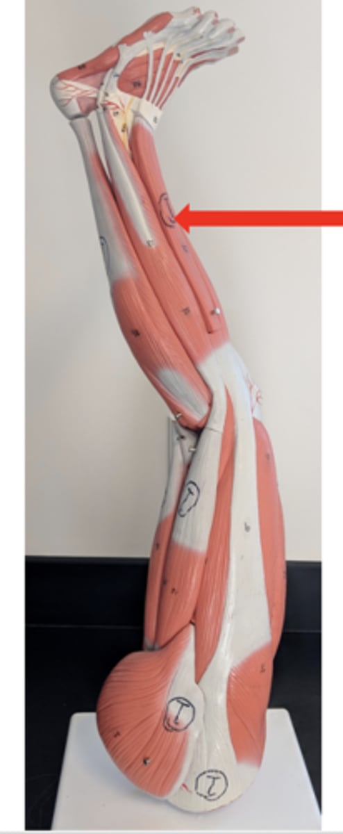 <p>what is this?</p>