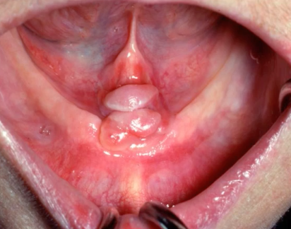 <p>diagnosis?</p>