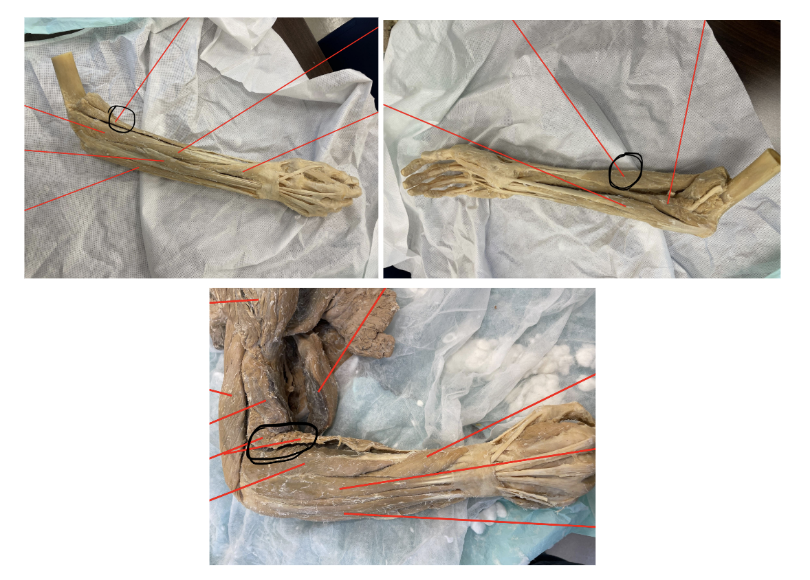 <p>what muscle do the marked images represent?</p>