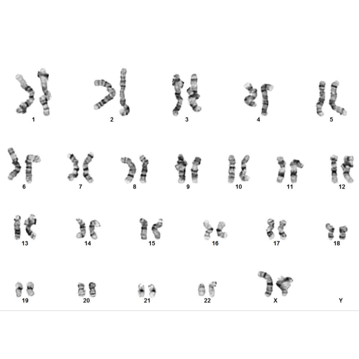 <p>What gender is this (karyotype)?</p><p></p>