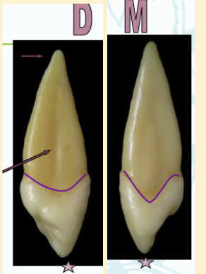 <p><mark data-color="green" style="background-color: green; color: inherit">maxillary canines #6 and #11; length</mark></p>