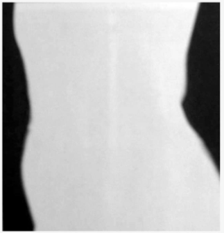 <p>A silhouette image such as this would result from what beam</p>