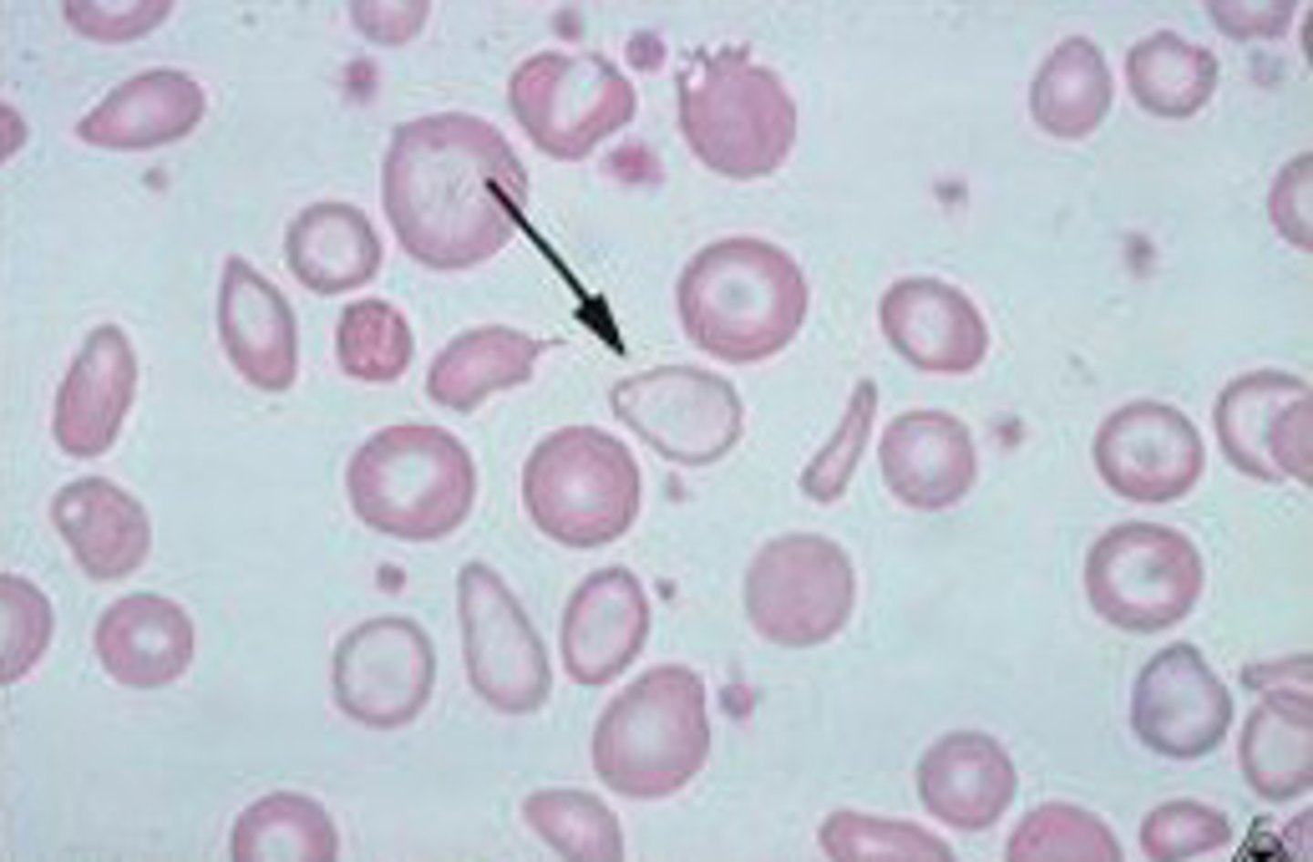 <p>little or no color in cell due to inuffeicient Hb with in the cell. Low Iron.</p>