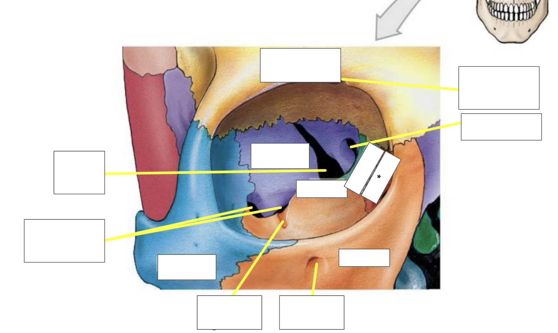 term image