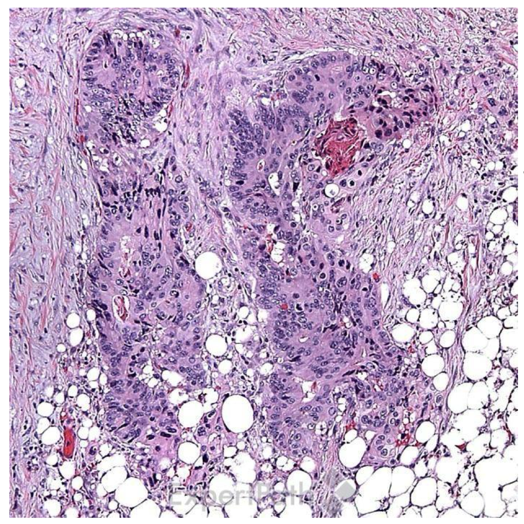 <p>what is the diagnosis?</p>