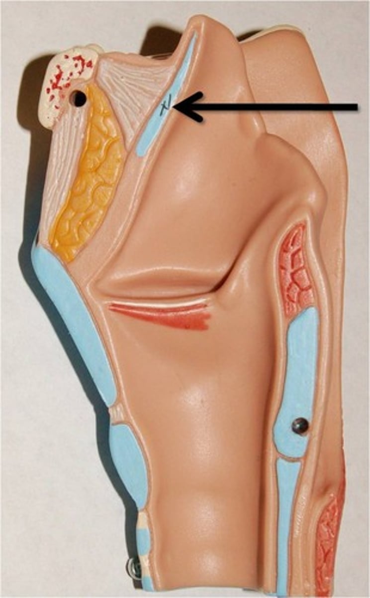 <p>name this structure.</p>