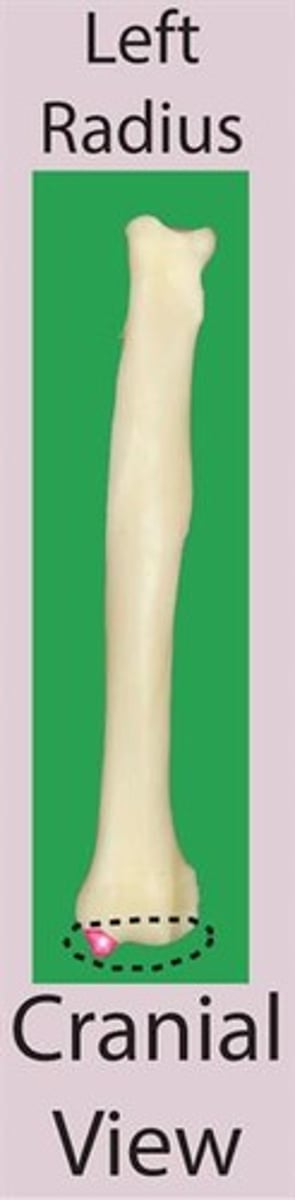 <p>distal extremity of the radius</p>