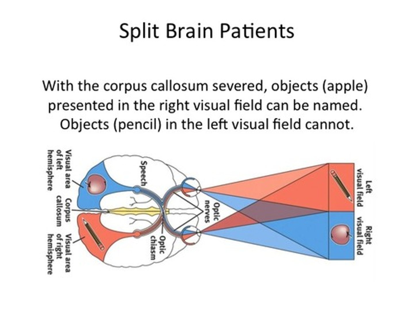 <p>A person with corpus callosum severed (often for reasons of eliminating seizures; misfiring in the brain)...in an experiment to show the separation of the hemispheres objects (an apple) presented in the right visual field CAN be named. Objects (a pencil) in the left visual field CANNOT. (Gazzaniga)</p>