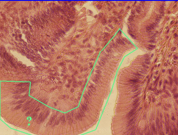 term image