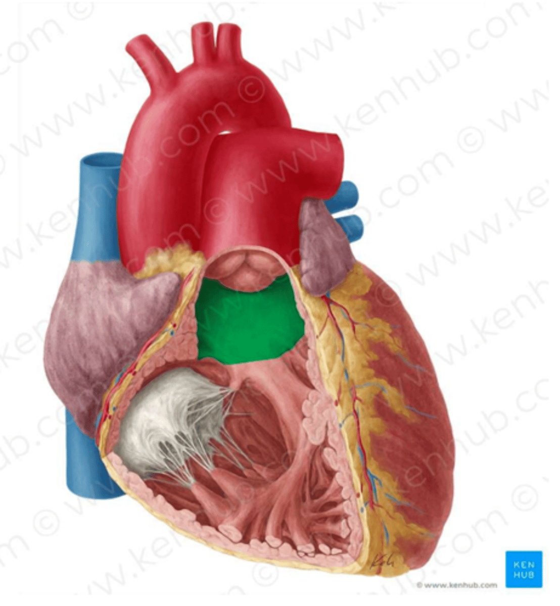 <p>Narrowing; v-shape before tube</p><p>H8</p>