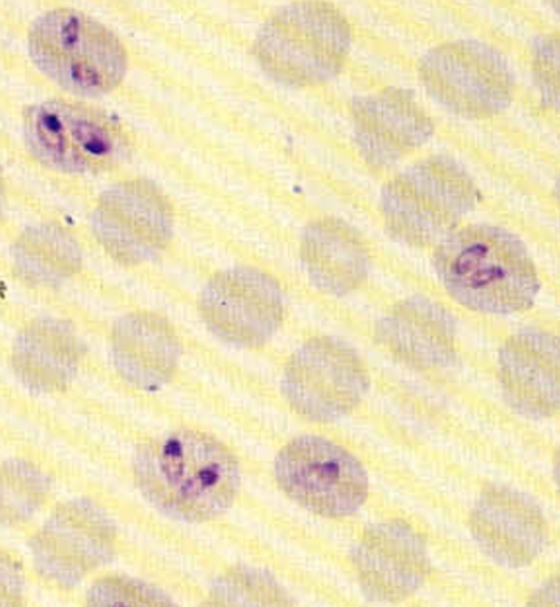 <p>Babesia</p>