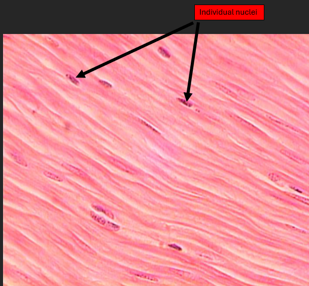 <p>Individual nuclei</p>