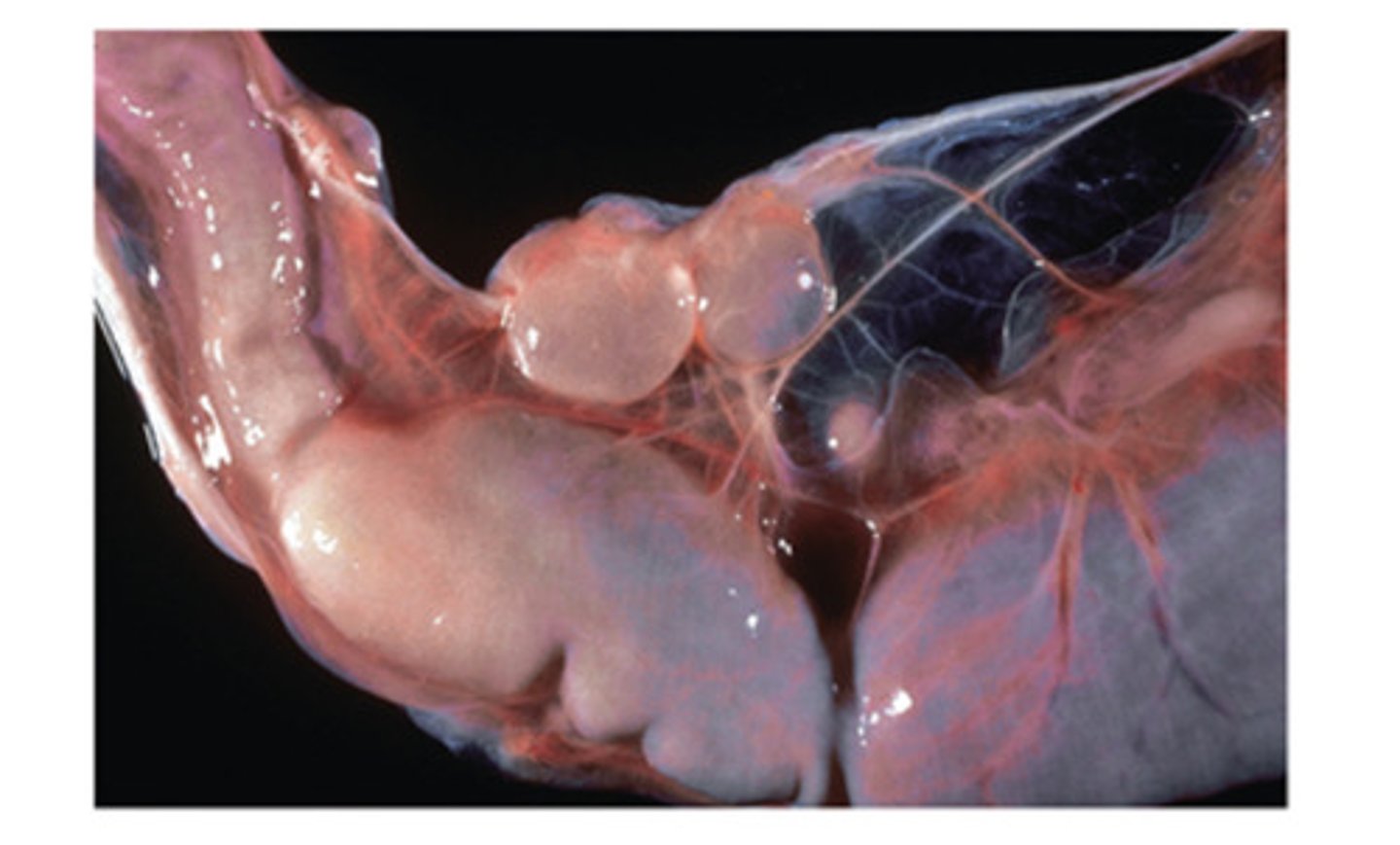 <p>This true tapeworm uses the dog as its definitive host. The metacestode stage is found in the abdominal organs and omentum of cattle, sheep, and goats. The genus and species for the metacestode stage is</p>
