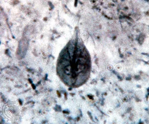 <p>in fresh human or animal stool</p><p>diarrhea, abdomen pain</p><p>worldwide</p>