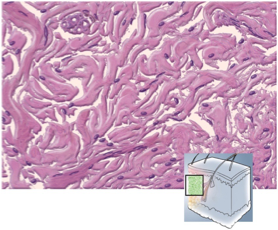 <p>Dense Irregular Connective Tissues</p>