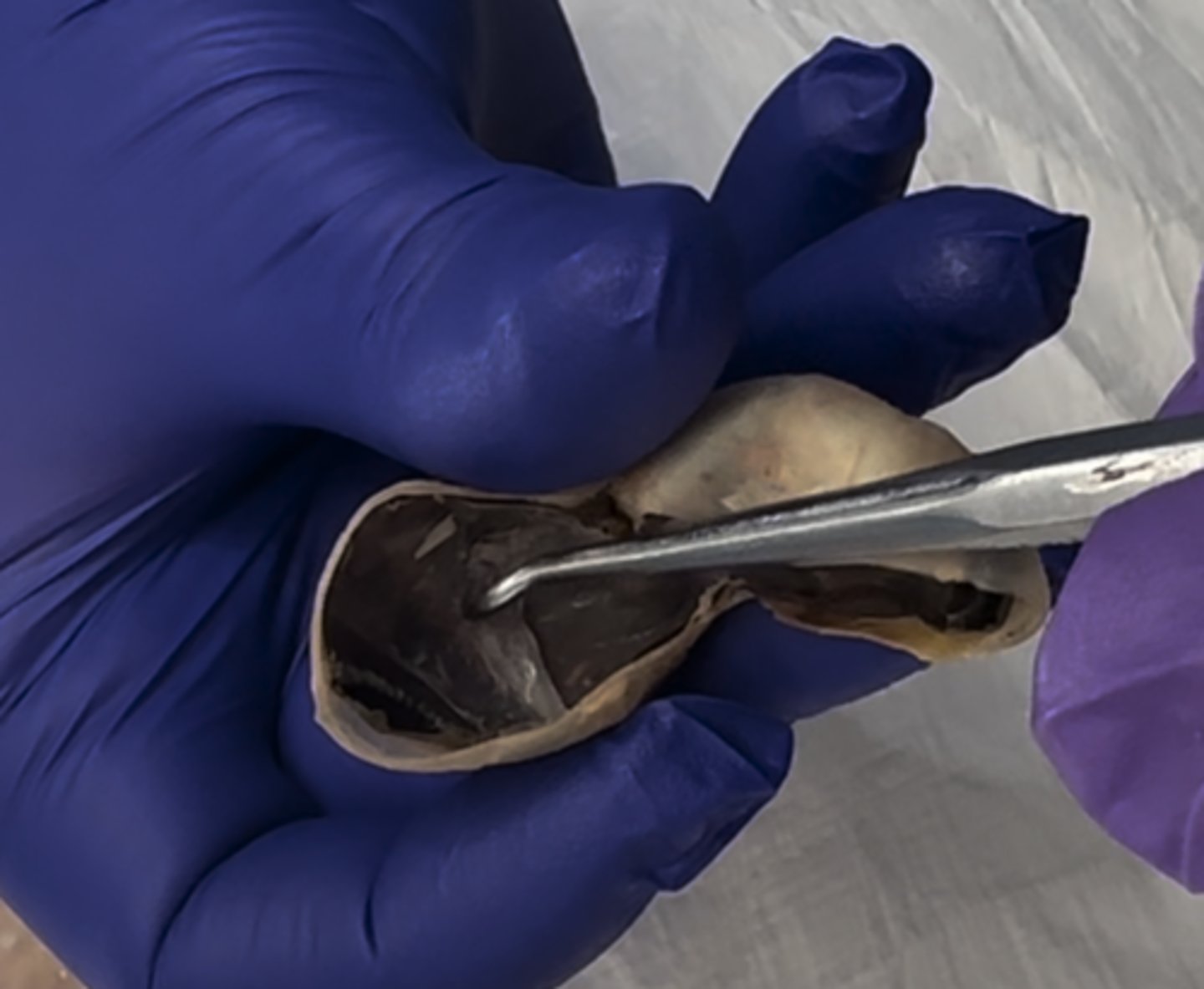 <p>What is the black part surrounding the inner body of the eye</p>