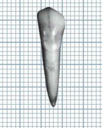 <p>what is the outline form for the mesial of mandibular left canine?</p><p>(the root and crown form is almost a straight line)</p>