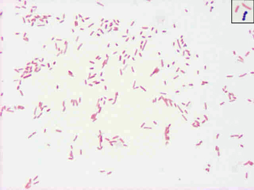 <p>small, pleomorphic GNR</p>