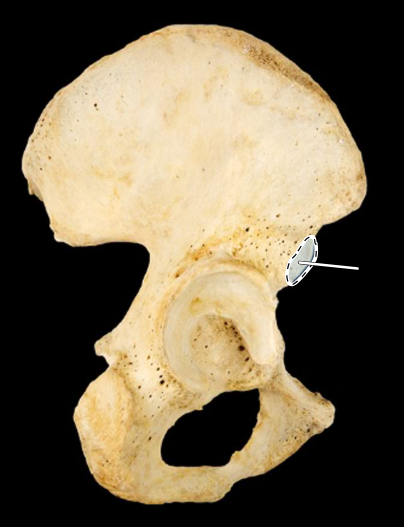 <p>Hip bone, lateral view, right ilium</p>