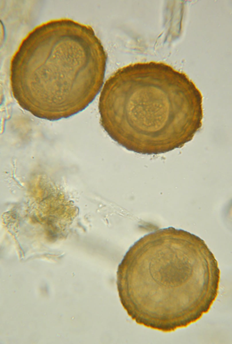 <p>The golden brown eggs were found on the fecal flotation of a 12 week old foal with a cough and nasal discharge . They measure approximately 90 um in diameter. What parasite is responsible for the eggs?</p>