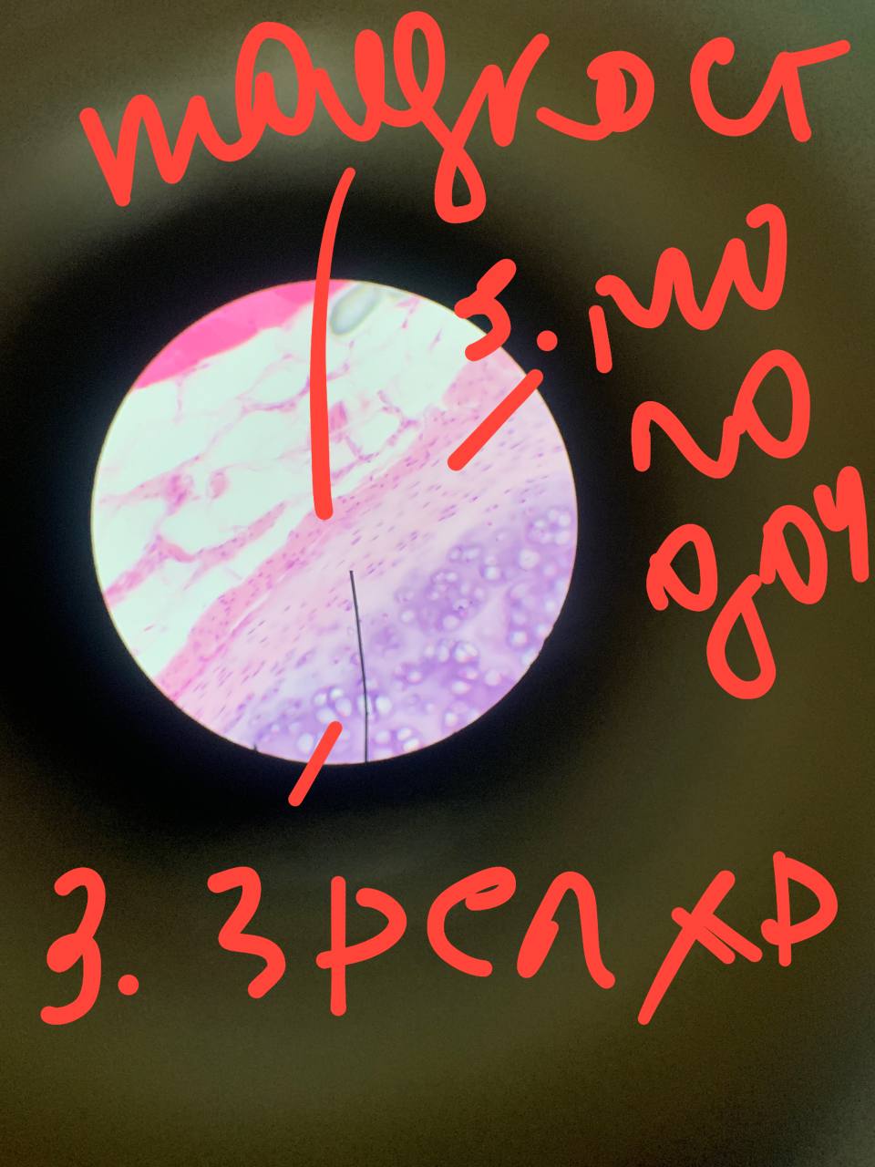 term image