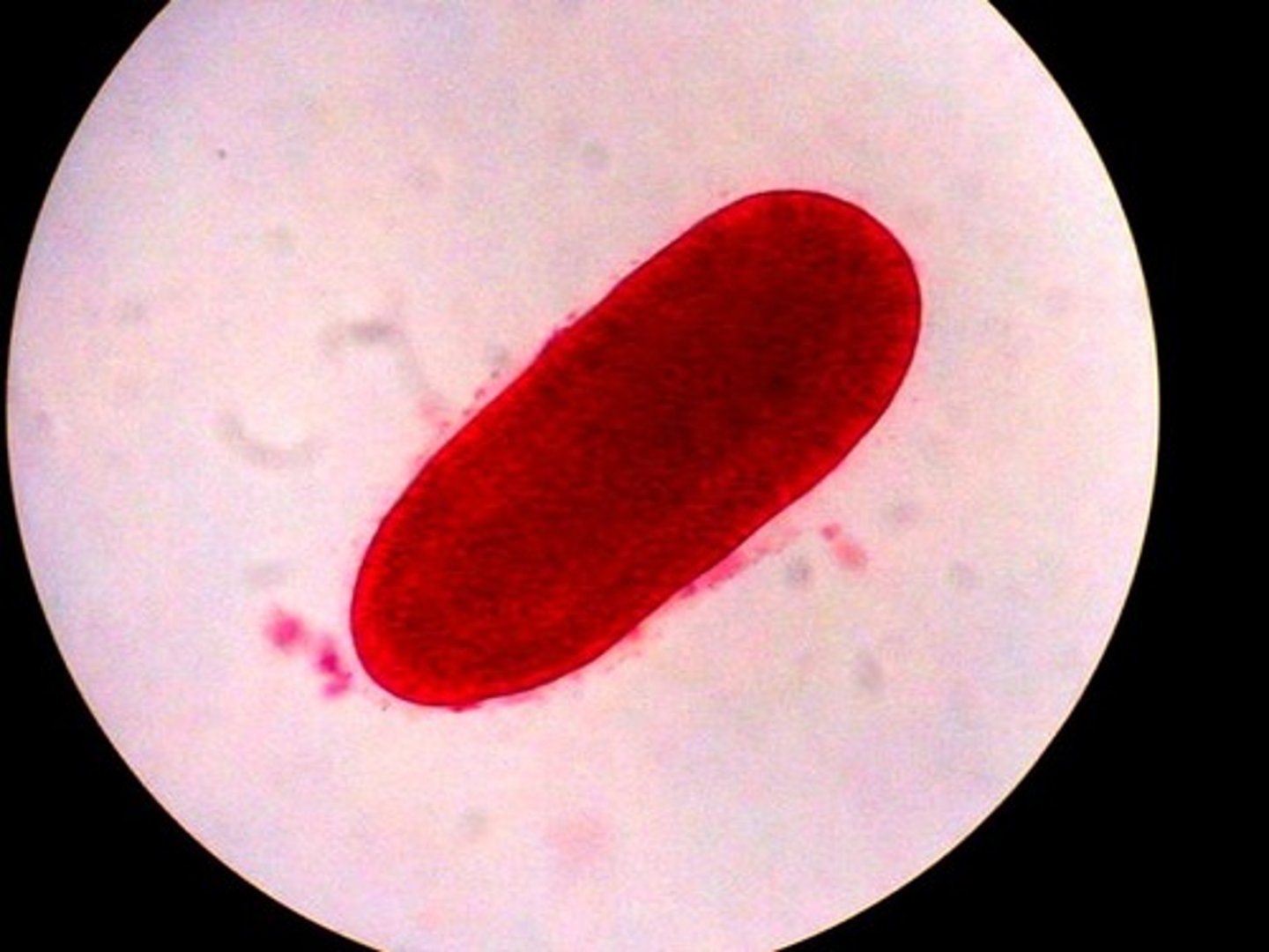 <p>Free-swimming, ciliated larval stage of cnidarians that eventually settles to form a polyp.</p>