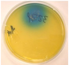 <p>canavinine-glycine-bromthymol blue agar:</p><p>pos rxn: blue color → C. gattii</p><p></p><p>MADLI TOF</p><p>DNA detection by PCR</p><p></p><p>impt to do bc treatment is more aggressive for C. gattii!</p>
