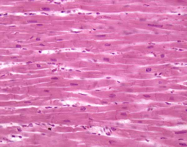 <p>cardiac muscle tissue </p>