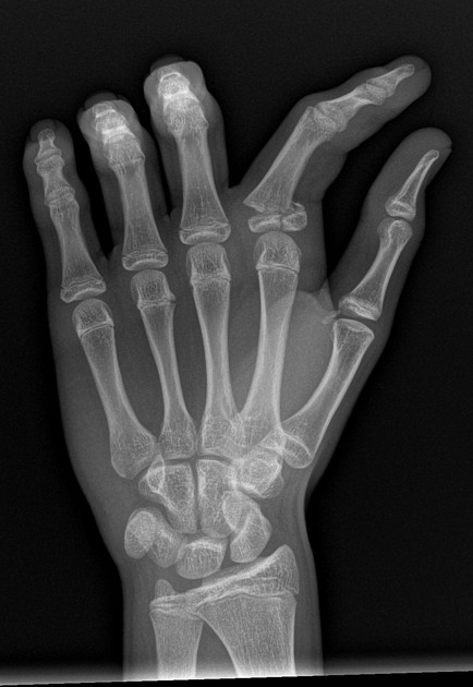 <p>Describe the abnormality demonstrated. </p>