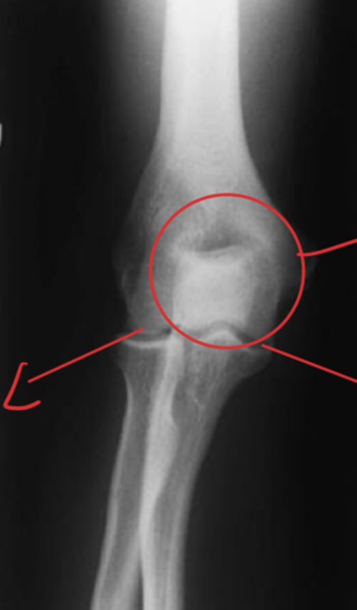 <p>What view is this?</p>