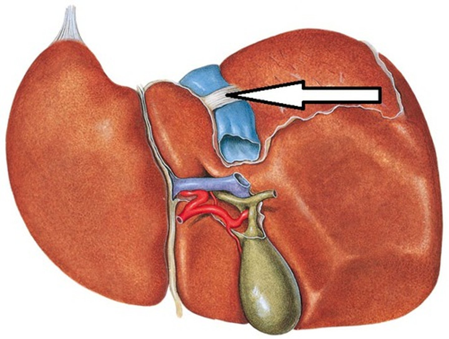 <p>Depression</p><p>- Top half of the right side of H</p>