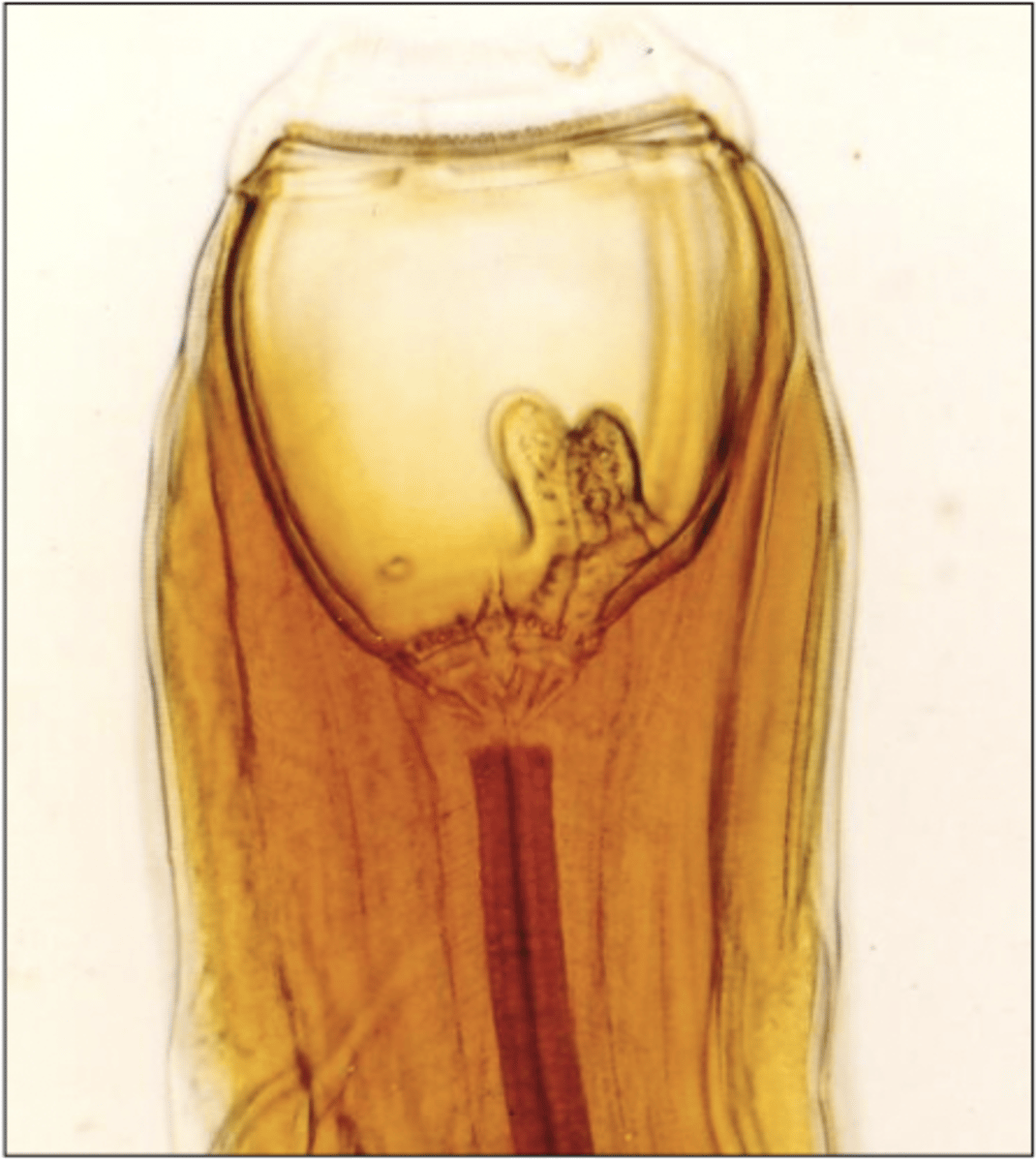 <p>What is this parasite? What characteristic/s did you use to identify it? (equine)</p>