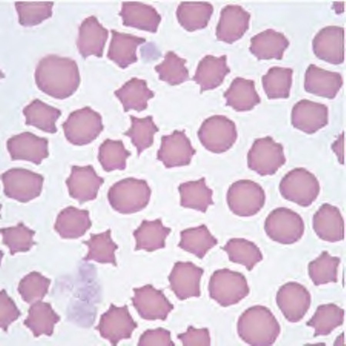 <p>cell with irregularly distributed small projections</p><p>(cell shape)</p>