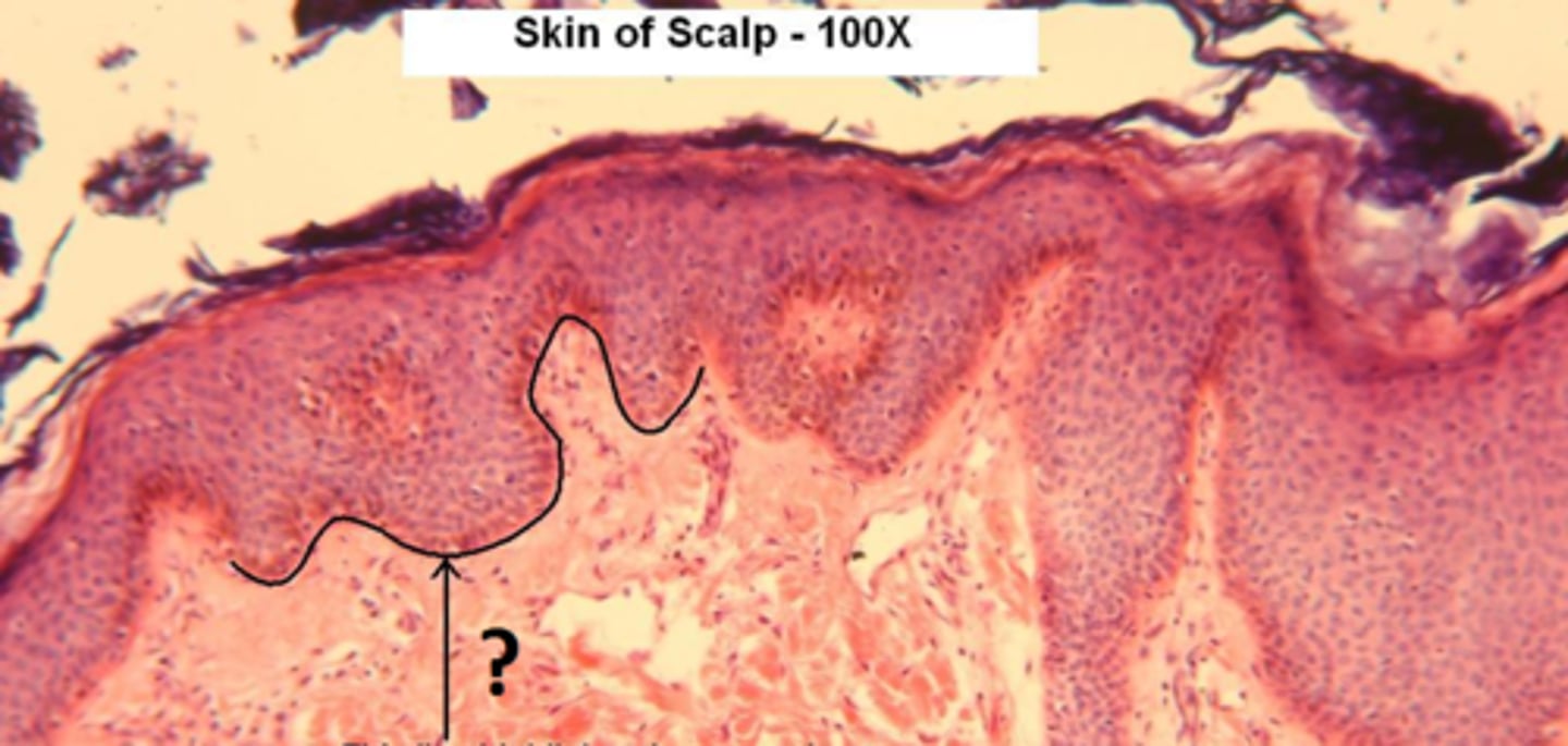 <p>Made of basal lamina and reticular lamina; reinforces epithelium, resists tearing, defines boundary.</p>