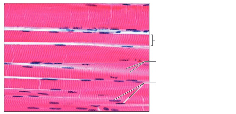<p>Label the following: Skeletal muscle fibers under a micrograph&nbsp;</p>