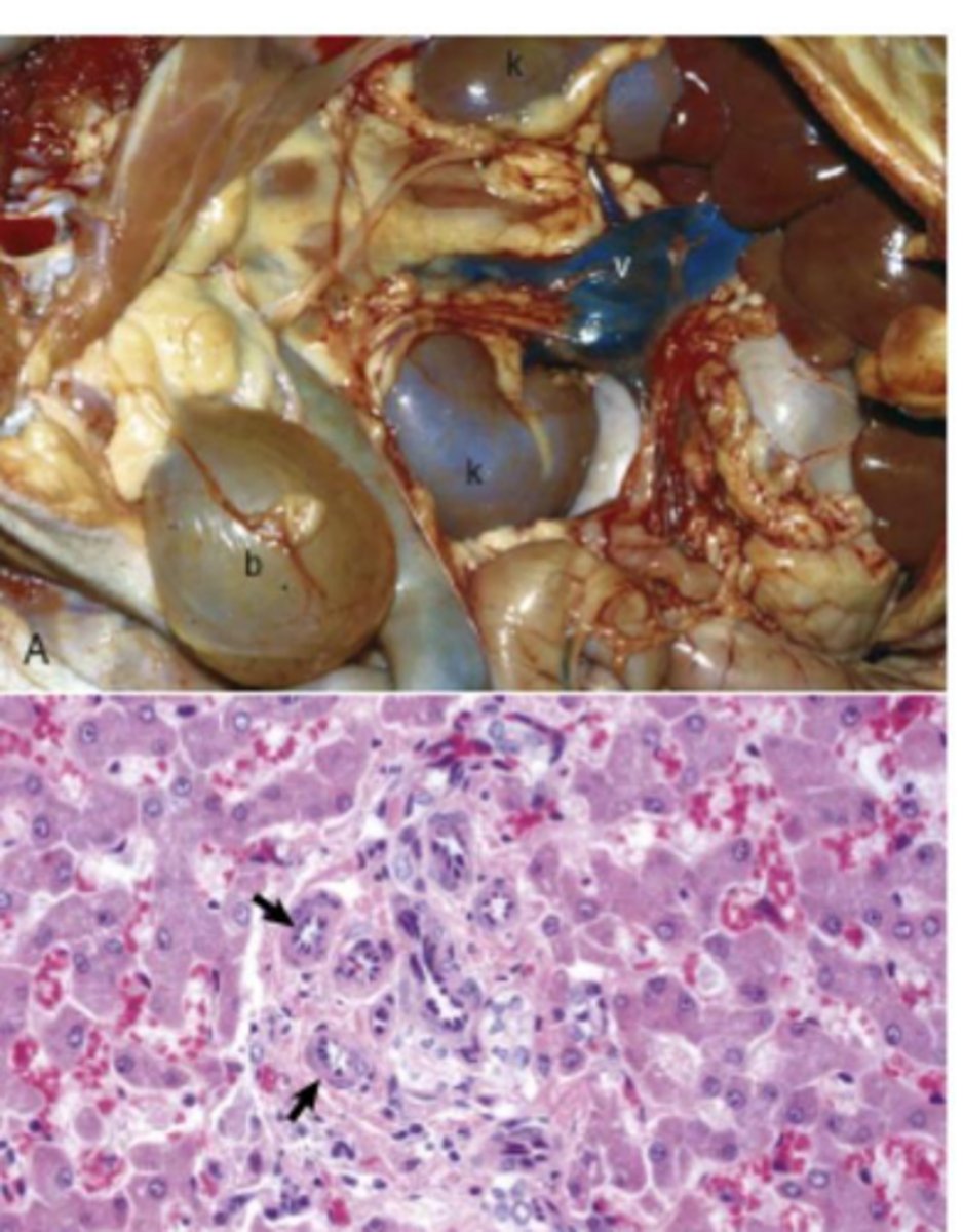 <p>Lipids, glycogen, amyloid, iron, copper, bile pigment, and products of lysosomal dysfunction.</p>