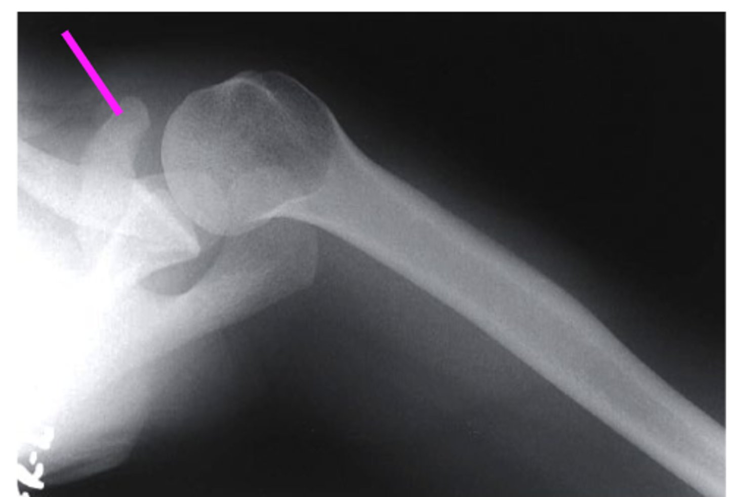 <p>what does the pink line point to?</p>