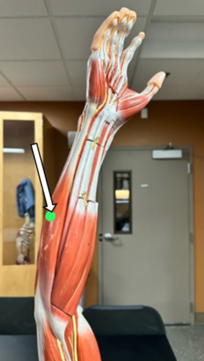 <p>flexor carpi ulnaris (function)</p>