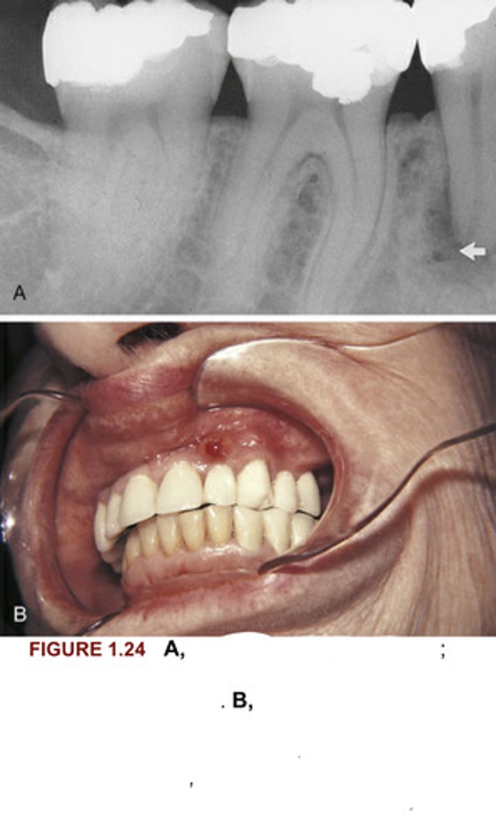 <p>Identify the diagnosis of images A &amp; B in figure 1.24</p>