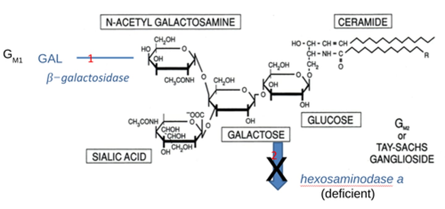 <p>-caused by hexoaminodase a (HEXA gene) deficiency</p><p>-A sphingolipidosis in which GM2 ganglioside accumulates in neural tissue and destroys neural cells in both the brain and neural retina.</p>