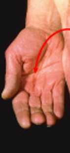 <p>Which special movement is:</p><ul><li><p>Foremen in anatomical position</p><ul><li><p>Turns palm up</p></li></ul></li></ul><p></p>