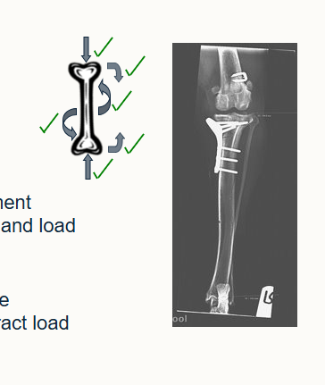 <ul><li><p>resist all 3 forces</p></li></ul><p><strong>screws:</strong></p><ul><li><p>apply friction between plate and bone</p></li><li><p>apply compression between fragments</p></li></ul><p><strong>plate: </strong></p><ul><li><p>internal splint, hold fractures parts in alignment</p></li><li><p>allows compression between fracture ends and load transfer</p></li></ul><p><strong>long bones loaded eccentrically:</strong></p><ul><li><p>results in tension side and compression side</p></li><li><p>position plate on tension side helps counteract load compressing on opposite side</p></li></ul><p></p>